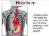 Heartburn