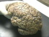 Anatomy_of_the_human_brain